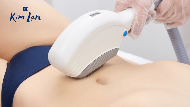 Triệt lông bikini bao nhiêu lần thì hết