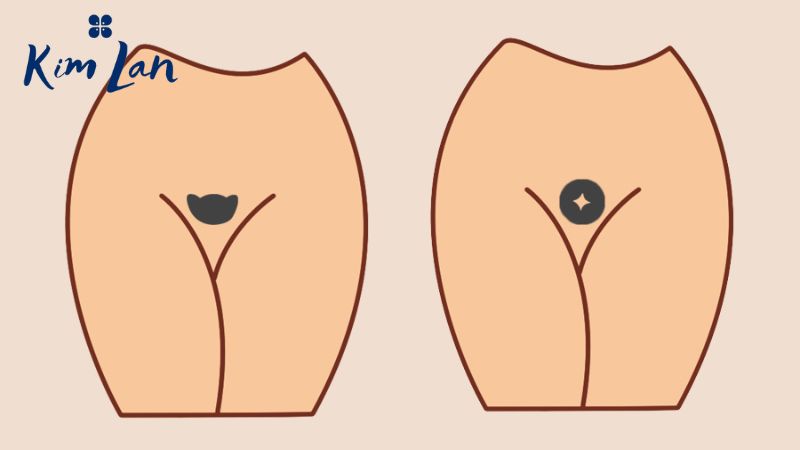Tạo hình bikini phong thủy theo mệnh kim